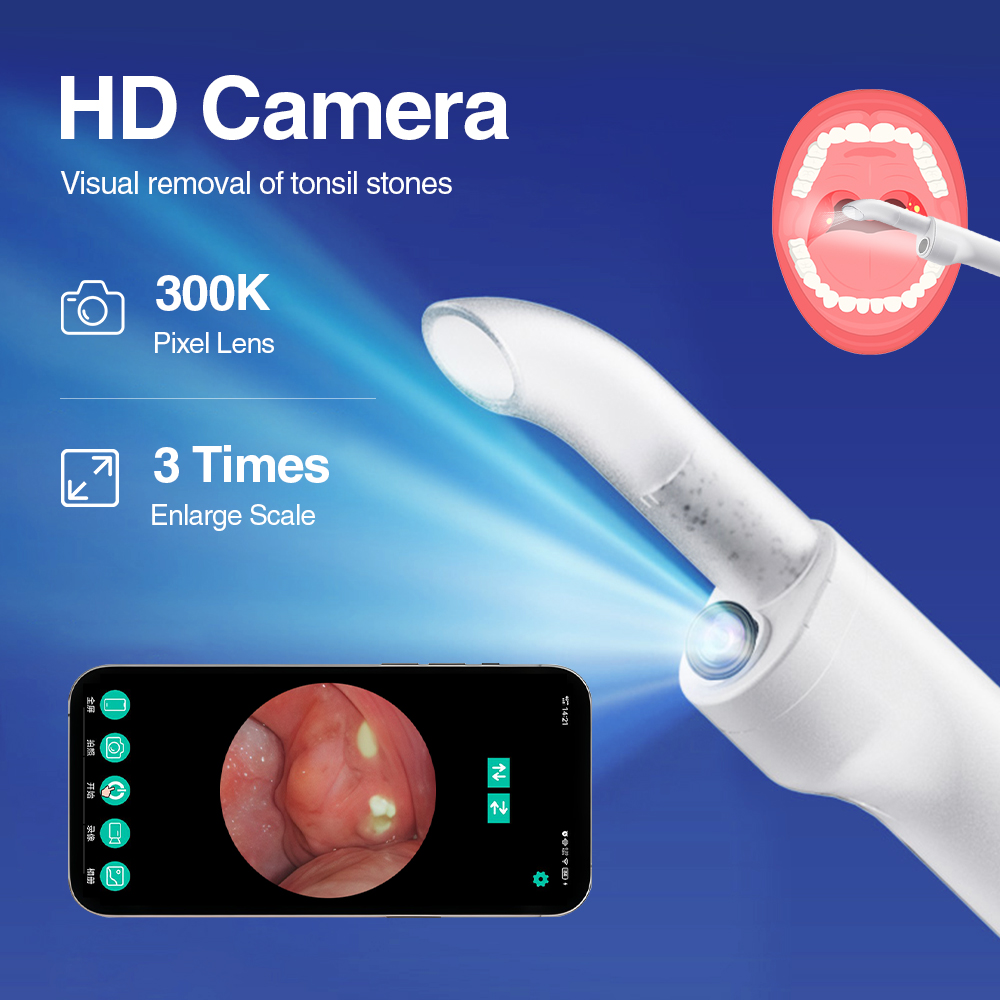 ชุดอุปกรณ์กำจัดก้อนทอนซิลแบบสม - Lighting Visual บทวิจารณ์และราคา